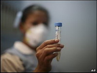 свиной грипп более опасен для дыхательной системы, чем сезонный
